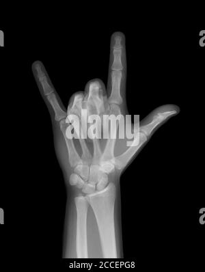 Rock on skeleton mano, raggi X. Foto Stock