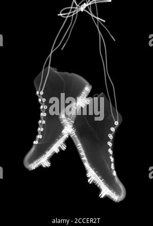 Scarpe da calcio, raggi X. Foto Stock