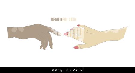 Mani con macchie di età o vitiligo vettore isolato gesti genetici della pelle malattia. Illustrazione Vettoriale
