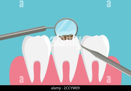 Esame dentale, denti e strumenti in stile piatto, illustrazione vettoriale stock. Illustrazione Vettoriale