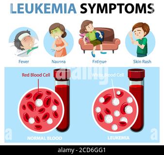 Sintomi leucemici illustrazione infografica stile cartone animato Illustrazione Vettoriale