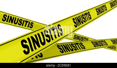 Sinusite. Nastri di avvertimento gialli con parole nere SINUSITE (infezione del seno o rinosinusite). Isolato. Illustrazione 3D Foto Stock