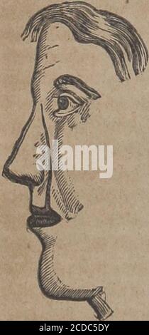 . Nuovi elementi di chirurgia operatoria. Un occhio-testimone a, e letto a eapprovato e corretto dal Dr. Mott. L'operazione è stata eseguita tra 1^ e 2§ P. M., sabato, novembre. 23, 1844. Il paziente, un giovane gentiluomo dal nome di William Edgar Baker, nativo di, e impiegato in una rispettabile impresa merlo-cantile in, questa città, e di età 25 anni, è stato messo in scena, di cornice ratherspessi, pieno temperamento sanguino, viso fiorito pieno, collo largo e petto, ma capelli e occhi scuri, e del tutto inclinedto embonpoint. Circa un anno da quando suo zio (presente nella stanza dopo la corda) mi ha detto il sig. Bakef co Foto Stock