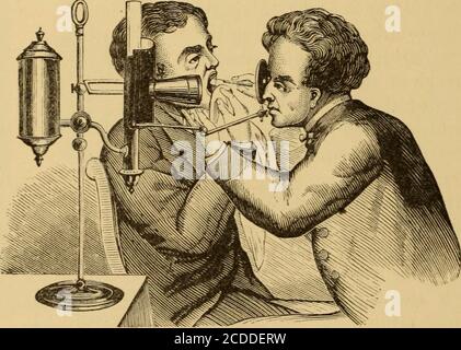 . Malattie della gola e dei passaggi nasali; una guida alla diagnosi e al trattamento delle affezioni della faringe, del sofago, della trachea, della laringe e delle narici . 42 ESAME DELLA GOLA E DEI PASSAGGI NASALI il metodo più conveniente è quello di utilizzare un nastro elastico per la testa. Nell'impiego della luce artificiale qualsiasi eccesso di luce del giorno dovrebbe essere chiuso. Una tonalità scura davanti alla finestra è sufficiente. Non è necessario escludere la luce solare tanto da rendere difficile distinguere gli oggetti in modo rapido intorno alla stanza. Il dottor Tobold ideò anche un piccolo illuminatore tascabile (Fig.26), per una più comoda trasportatio Foto Stock