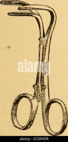 . Malattie della gola e dei passaggi nasali; una guida alla diagnosi e al trattamento delle affezioni della faringe, del sofago, della trachea, della laringe e delle narici . Fig. 6.- Duplay speculum nasale. ISPEZIONE DIRETTA DEI PASSAGGI NASALI. 15 Dr. Elsbergs speculum di dilatazione a tre valvole in acciaio (Fig. 7), modellato sul dilatatore tracheale Labordes, è uno strumento molto serviceableableable, dilatando la narice verticalmente così come a orizzonte-tally. Il Dott. Thudichums dilata speculum (Fig. 8) è uno specolo silverbilaterale, i due lati dei quali sono in collegamento mediante un anello di filo elastico, che funge da dilatatore per tenere Foto Stock