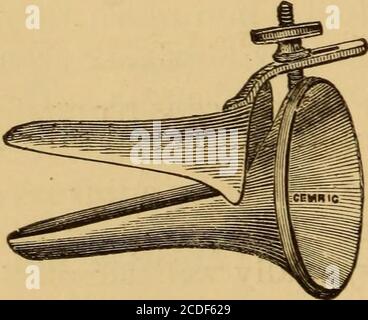 . Malattie della gola e dei passaggi nasali; una guida alla diagnosi e al trattamento delle affezioni della faringe, del sofago, della trachea, della laringe e delle narici . Fig. 5.-esame del passaggio natale antero con retrattore del pelo. (Da un disegno del Dott. Praeger.) a sua volta sulle pareti dei passaggi, a poco a poco. Speculum di sbivalvi Duplay (Fig. 6) è preferito da molti. Esso viene spinto indietro fino alle posizioni delle ossa del tenaso, in modo da dilatare le porzioni carti-laginose del passaggio, bypassando una vite di fermo. Il Dott. Zaufal, di Praga, ha recentemente estollato uno speculum allungato, con cui clai Foto Stock