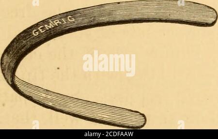 . Malattie della gola e dei passaggi nasali; una guida alla diagnosi e al trattamento delle affezioni della faringe, del sofago, della trachea, della laringe e delle narici . Fig. 2.-Tuercks lingual-depressor. 1 Lehrbuch der Laryngoskopie, edizione 2d. Berlino, 18G9, pag. 43.. ISPEZIONE DIRETTA DELLA GOLA. 11 il dottor Voltolini raccomanda di estrarre la lingua il più possibile, e di posizionare il linguadepressore il più indietro possibile allo scopo di indurre il retching, che espone la parte inferiore della faringe a una vista momentanea directhough. Un abbassalingua ideato da myself3 (Fig. 3) presenta un certo vantaggio Foto Stock