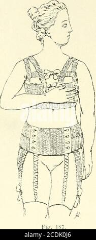 . Les seins dans l'histoire . Fig. lt&gt;() /t (JN-stt ancien et modo le Gaches-Sarrauli-. il empêche côtes - contrairement aux corsets llioraciqucs - la com-pression fie lestomac et des à ; tels sont les avantages du cor-set hygiéni(|ue inventé par une doctoresse, M Gaches use-Sarraute.Uncorérie addome objections : Uncorérie Uncorérie   il ne soutientpas les seins ; les femmes ne peuvent admettre que ces tumeurspectorales soient al)andonnées à leur propre poids. Mais notre émi- 288 LK S PELLI DANS . H i S T (&gt; i li K nciitc pralicnne ne ne sarrête pas à cette critique : lexpérience luia démontr Foto Stock