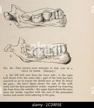 Quain's Elements of Anatomy col. III pubblicato nel 1896, un osso mandibolare del bambino. Foto Stock