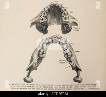 Quain's Elements of Anatomy col. III pubblicato nel 1896, un osso mandibolare del bambino. Foto Stock