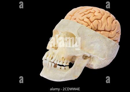 Cranio umano con cervello su sfondo nero Foto Stock