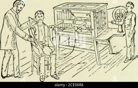 . Elementi essenziali dell'elettricità medica . Paziente trattato con Static.Fig. 37.. Paziente trattato con static. Ma è disposto per accadere ad una distanza dal sottobosco soggetto, ma naturalmente fa parte del circuito con il paziente. L'elettrodo, che l'autore chiama l'elettrodo unisalal statico, è rappresentato in Fig. 38. La scintilla si verifica tra le due sfere ; queste ultime possono essere asseparate o approssimate mediante un grilletto. I vantaggi rivendicati per questo metodo sono forti contrazioni di muscoli con poco dolore; mentre i filamenti motori sono 74 ESSENZIALI DI MEDICINA Foto Stock