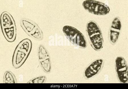 . Endoshia parassitica e specie affini . TH, quasi liscio su thesurface. Il micelio superficiale era giallo arancio chiaro. Le masse di spore gialle-ocra pallido erano minute, molto numerose, e quasi coperto la sur-face. Il mezzo era leggermente verdastro attorno ai lati del pallone sotto il micelio. CARATTERI DISTINTIVI DELLE VARIE SPECIE SULLA FARINA DI MAIS IN FIASCHE. Le reazioni cromatiche delle varie specie sulla farina di mais sono molto impressionanti. Endothia fiuens (PI. XXI, fig. Lb), come sopra indicato, cambia la massa intera del mezzo in viola perilla in meno di un mese. E. girosa ed E. Foto Stock