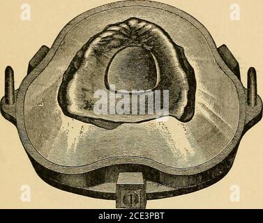 . Un manuale di odontoiatria meccanica e di metallurgia . saggiamente, l'effetto dello stippling è verypletely. Modo di Flasking. - il flasking o l'investimento di thecase dovrebbe ricevere abbastanza tanta cura come in gomma work.First montare il modello alto nella metà poco profonda del pallone, specialmente progettato per celluloide. Versare il cartongesso fino a raggiungere il bordo inferiore della piastra. Quando l'intonaco è regolato a sufficienza, tagliarlo alla forma appropriata per separarlo, quindi ricoprirlo con il sapone liquido. Inserire l'anello profondo del matraccio in posizione e riempire con estrema cautela LA CELLULOIDE COME BASE DENTALE. 67 Foto Stock