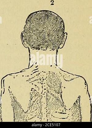 . Elementi essenziali della diagnosi. Organizzato sotto forma di domande e risposte preparate specialmente per gli studenti di medicina . Fig. 45.. Foto Stock