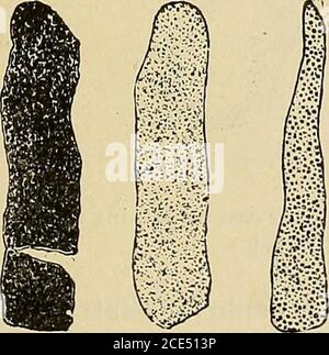 . Elementi essenziali della diagnosi. Disposto sotto forma di domande e risposte preparate specialmente per gli studenti di medicina. M globuli rossi di sangue e un ricino di sangue un tubulo urinifero. (Eichorst.) Fig. 39.. Foto Stock