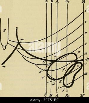 . Elementi essenziali della diagnosi. Disposto sotto forma di domande e risposte preparate specialmente per gli studenti di medicina. Ittero intenso; ma in caso di malattia maligna vi è anche emaciazione progressiva, morte che si verifica di solito entro un anno dalla scoperta della teesistenza della malattia. Attacchi di coliche epatiche assistono alla loro resenza di calcoli biliari nei passaggi biliari. L'ostruzione dipendente dai calcoli può essere superata, spontaneamente o terapeuticamente. Senza sollievo, la morte ultimatelyrisulta da acholia o colemia. La diagnosi è spesso estremamente difficile. L'incertezza aumenta Foto Stock