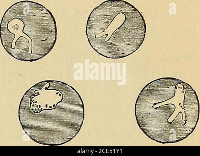 . Elementi essenziali della diagnosi. Organizzato sotto forma di domande e risposte preparate specialmente per gli studenti di medicina . Organismi di malaria – iutacorpuscolus.Fig. 8. Foto Stock