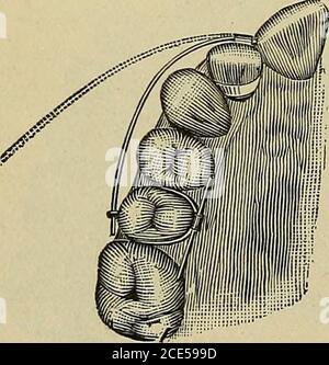 . Ortodontia, o malposizione dei denti umani; la sua prevenzione e rimedio . Conservazione. Fig. 39.. Rotazione. (Angolo.) MATERIALI E METODI. 105 Foto Stock