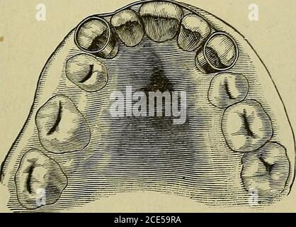 . Ortodontia, o malposizione dei denti umani; la sua prevenzione e rimedio . Fermo. Fig. 19.fermo.. Fascetta e fermacavi. 88 ORTODONTIA. Foto Stock