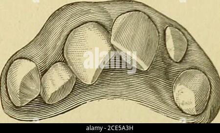 . Ortodontia, o malposizione dei denti umani; la sua prevenzione e rimedio . PRINCIPI COINVOLTI. 39. Torsione di entrambi i centruK. lino. Trascurare la condizione o rimandarne la correctionederebbe non solo nella sua conferma e probabile agra-vazione, ma potrebbe anche aprire la strada ad un cambiamento completo della forma dell'arco. Fig. 10 illustra questa condizione. È del tutto probabile che in questo modo Fi«- lo siano stati formati alcuni archi di una sliape a V modificata. In casi come quelli citati, l'interferenza precoce è il piano più saggio, ma è equallyg^^^ ^^^.^^^importante che dopo Foto Stock