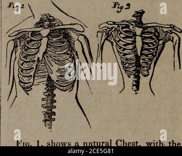 . La rivista medica popolare, e medico di casa : una rivista mensile, dedicata alla diffusione di informazioni popolari su anatomia, fisiologia, le leggi della salute, e la cura della malattia. spazio ge. TheRibs sono così Uniti al Bonesas sopra chiamato per essere in grado di muoversi su e giù, per aumentare e diminuire la dimensione della cav-ity del torace. Ciò è necessario nel processo di respirazione, perché quando i luunghi sono riempiti di aria, come quando ci trafiliamo nel respiro, devono, naturalmente, essere muchJar^er che quando il respiro è espulso. Ve eannot respirare perfettamente, quindi, ui.less le ossa di Foto Stock