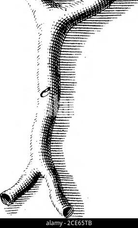 . Una descrizione anatomica del cuore delle tartarughe terrestri dall'America. Del Sig. Paul Bussiere, chirurgo, F. R. S. Foto Stock