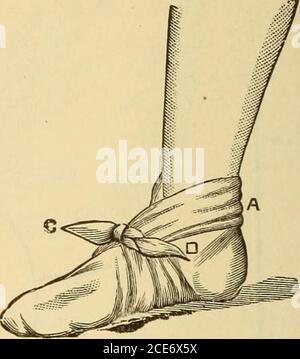 . Dr. Evans' come mantenere bene; . Fig. 367.-Tkiangle bendaggio a piedi. Il piede dovrebbe essere messo sulla trianglecon la base A indietro, e posato behindthe caviglia, l'apice essendo portato sopra il dormiente o la parte superiore del piede. Le estremità tebasali C e D vengono portate in avanti, incrociate, poi portate intorno al piede, e legate in cima. Fig. 366. - Figura di banda dell'altezza del piede della caviglia. Numeri in-dicate rotta presa dalla banda- Foto Stock