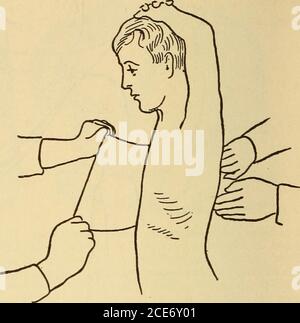 . Dr. Evans' come mantenere bene; . Fig. 357.-Abito temporaneo per frattura del Clav-icle. Fig. 358.-reggiatura con pasta adesiva per Broken Rib. Arsenico.-Antidoto: oxide idrata di ferro con magnesia. Alkalies (come Lye, polveri di lavaggio, ecc.).-antidoti: Vite- Foto Stock