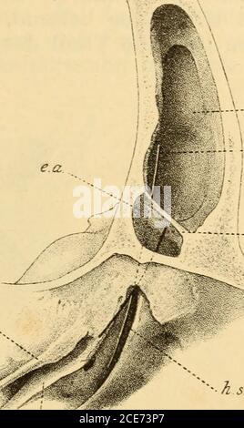 . Pathologie und Therapie der entzündlichen Erkrankungen der Nebenhöhlen der Nase . in das Lumen der Stirn-höhle stark hervorragenden Blasekommen, so dass dann in die eigent-liche Stirnhöhle eine zweite Höhle,welche dann dem Siebbeinlabyrinthangehört, eingeschaltet erscheint. Es wird schon aus den ange-führten anatomischen Thatsachenklar, dass das vordere Ende desSiebbeinlabj^rinthes mit dem nasalenTheile der Stirnhöhle in nahe topo-grafische Beziehungen tritt, derent-halben die Differentialdialdiagnosis derEiterungen der Stirnhöhle und Siebbeinzerblegergenite Schugen Foto Stock
