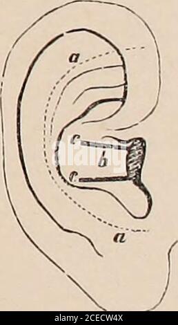 . Lehrbuch der Ohrenheilkunde für Ärzte und Studirende. Fig. 5. Foto Stock