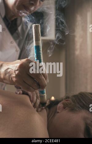 Terapista che esegue un trattamento di moxibuzione. Terapia medica cinese Foto Stock
