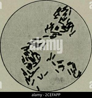 . Microrganismi patogeni, compresi batteri e protozoi; un manuale pratico per studenti, medici e operatori sanitari. Fig. 100. Bacilli tifoidi da agar nutritivo. Diametri XlLOO. Bacilli tifoidi di gelatina nutritiva. Diametri XlLOO. Fig. 101 Fig. 102 Foto Stock
