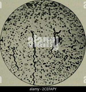 . Microrganismi patogeni, compresi batteri e protozoi; un manuale pratico per studenti, medici e operatori sanitari. Bacilli tifoidi di agar nutritivo.diametri XlLOO. Bacilli tifoidi di gelatina nutritiva. Diametri XlLOO. Fig. 101 Fig. 102. Flagella, fortemente macchiata, attaccata tabacilli. (Metodo van Ermengens.) Foto Stock
