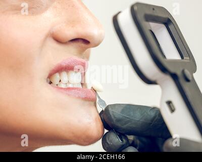 Mano del dentista che sceglie la tintura della dentiera per la donna Foto Stock