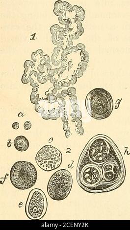 . Anatomia, descrittiva e chirurgica. Il Dott. Watney ha anche scoperto, nel linfoissue dal timo, cellule simili a quelle trovate nella ghiandola, e, come loro, contenenti emoglobina, sotto forma di granuli o masse. Da questi fatti si giunge alla conclusione fisiologica che il timo è una fonte dei corpuscoli sanguigni col-ored. Questi punti sono illustrati nel disegno allegato del Dott. Watney (Fig.624), per il quale devo esprimere i miei ringraziamenti a lui. Vasi e nervi.- le arterie che forniscono il timo sono derivate dalla mammaria interna e dal superiore e in Foto Stock