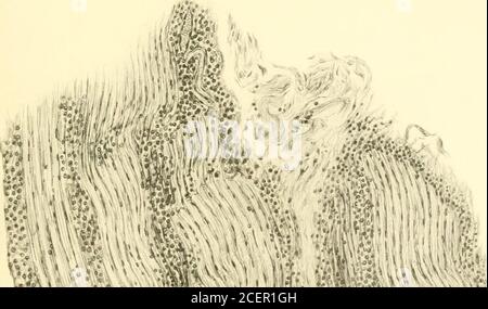 . Contributi del Dipartimento di Neurologia e del laboratorio di Neuropatologia (ristampe). 4 malattia di Rhein dei nervi radicolari --^ ISTERIA, CHE COSA È E CHE COSA NON È.* da CHARLES K. MILLS, M. D., Professore di Neurologia all'Università della Pennsylvania; Meurologisl al Philadelphia General Hospital. {dal Detortnient of Neurology dell'Università della Pennsylvania.) L'isteria, un tema favorito con gli scrittori medici fin dal tempo del padre della medicina, è venuto di nuovo al fronte sotto l'influenza thestulating di Babinski, che ha attratto l'attenzione della neurologica Foto Stock