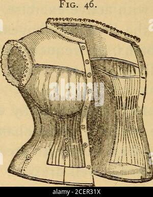 . Infermieristica in chirurgia addominale e malattie delle donne. Orecchie hanno fatto un grande cambiamento. E 'nolonger necessario per una donna di vestirsi infortuniosamente togHealth per essere ben vestito. I modelli del Jenness-Miller reform Abito indossare e altri sistemi di riforma dell'abito mirano a correggere requisiti formerunigienico. La costrizione del thechest causata dall'uso dei corsets; la pressione e la paralisi parziale della muscolastica addominale e toracica da vestiti stretti e pesanti; la posizione innaturale degli organi pelvici come conseguenza di tale pressione, erano il risultato inevitabile di ex fashionablemodes di vestirsi Foto Stock