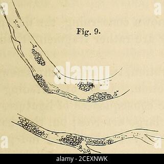 . Lezioni di patologia chirurgica : consegnate al Royal College of Surgeons of England. Foto Stock