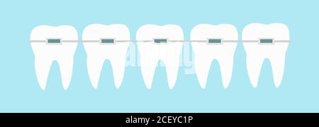 Cinque denti con bretelle dentali linea su sfondo blu illustrazione vettoriale. Trattamento ortodontico Illustrazione Vettoriale