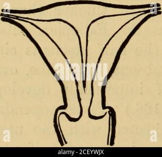 . Malattie delle donne. Una guida clinica alla diagnosi e al trattamento. Fig. 169.-diagramma che illustra uterusbicornis semiduplex. (Giles.) Fig. 168.-diagramma che illustra il duplex uterusbicornis. (Giles.). Foto Stock