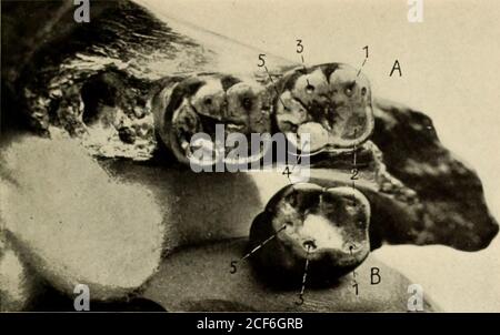 . Opuscolo della guida. Fig. 10. .1, laterale e a))) viste della mascella del busto Piltdown Dawn Man. Con i denti molari primo e secondo inferiore in posizione, li, viste laterali e dall'alto del primo dente molare inferiore di si cond PiltdownDawn Man. Circa tre quarti delle dimensioni naturali. Dopo Smith Woodward. 18. J Fig. 11. I molari inferiori della ganascia Piltdown, Mich indossavano ma mostravano il modello pure Dryopithecus.-A, il primo campione. B, il secondo campione. Le fotografie, del professor J. H. McGregor, sono invertite per facilitare il confronto con la Fig. 12. Foto Stock