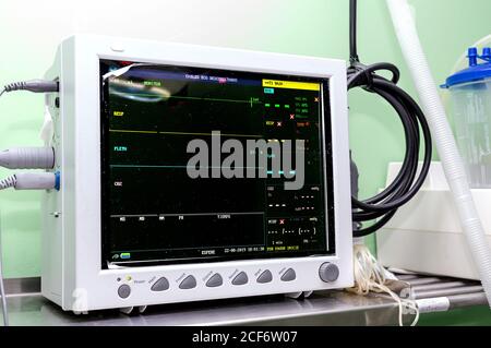 Monitor elettronico che visualizza i segni vitali e la frequenza cardiaca del paziente in sala operatoria di clinica moderna Foto Stock