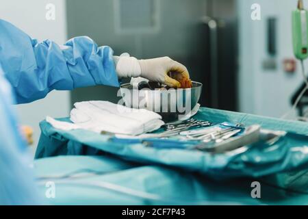 Ritagliare la mano del medico in abito blu e guanto bianco schiacciare il tampone pieno di iodio nella ciotola durante l'intervento chirurgico Foto Stock