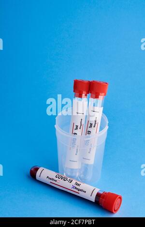 Dalla parte superiore, la provetta per analisi con i campioni di sangue nella provetta coppa in plastica per test diagnostico del coronavirus con contrassegno negativo su sfondo blu Foto Stock