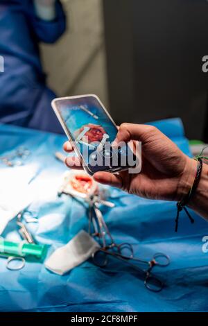 Ritaglio ad angolo elevato maschio che fotografa con smartphone mentre chirurghi concentrati in interventi chirurgici ad esecuzione uniforme utilizzando attrezzi speciali in sala operatoria di ospedale moderno Foto Stock