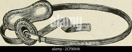 . Ernia addominale : diagnosi e trattamento. Posizione in cui la molla dovrebbe poggiare intorno all'anca. A metà strada tra cresta di iium e tro-chanter Major, la sua fine in (ronl sopra anello interno. Se viene attraverso l'addome deve termi-narsi allo stesso punto. L'anca del (lato del corpo. Come originallj fatto questo caprino hada cuscinetto convesso sopra la regione inguinale, tenuto alla molla da fissaggio aball-and-socket. La molla dopo aver passato l'addome di acrostie e intorno all'anca di fronte all'ernia, terminatedover la spina dorsale, dove c'era un altro cuscinetto circolare tenuto dal metodo di attacco thesame. Questa t Foto Stock