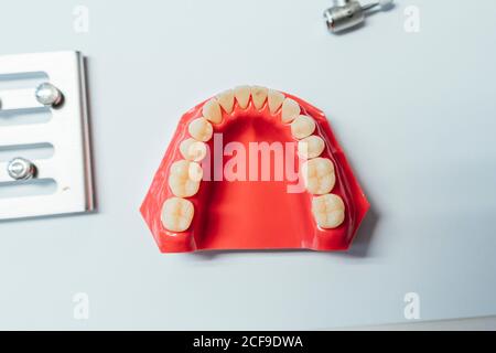 Closeup di una dentiera in un laboratorio Foto Stock