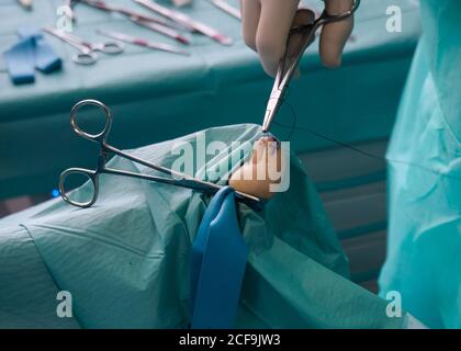 chirurgo irriconoscibile su guanti in gomma che utilizzano strumenti chirurgici durante la sterzata su ferita sulla punta grande dei piedi in ospedale Foto Stock