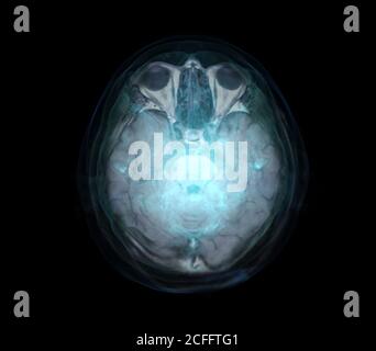 Immagine trasparente del colore blu cranio AP con il concetto di sfondo Brain for Medical. Foto Stock